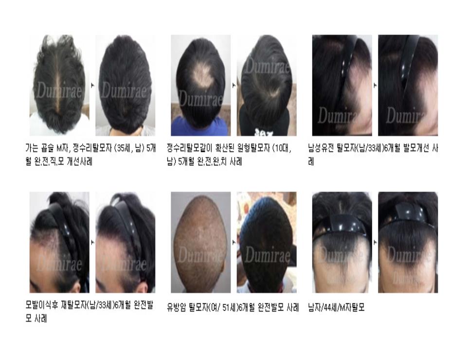 두미래 임상 사례 모음 1